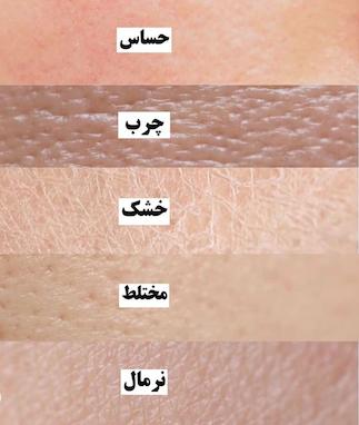 انواع پوست‌